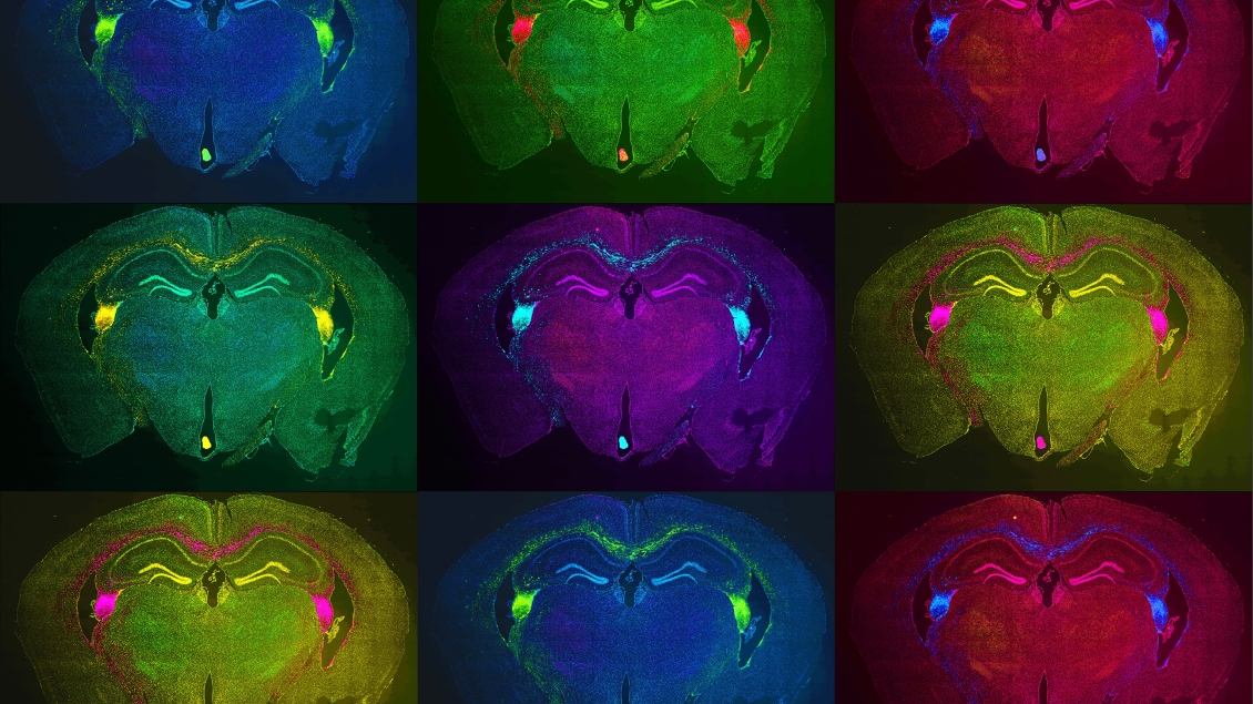 Colored mouse brains with transplanted stem cells